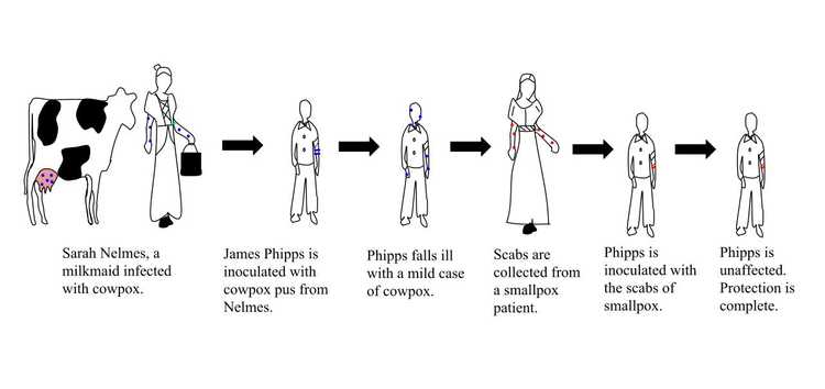 Edward Jenner Smallpox vaccination steps