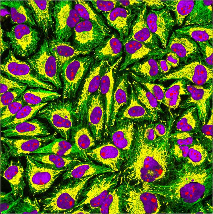 Immunofluorescence imaging of HeLa cells